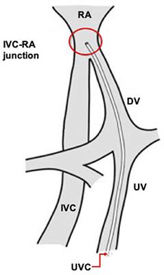 Frontiers Umbilical Venous Catheter Update A Narrative Review